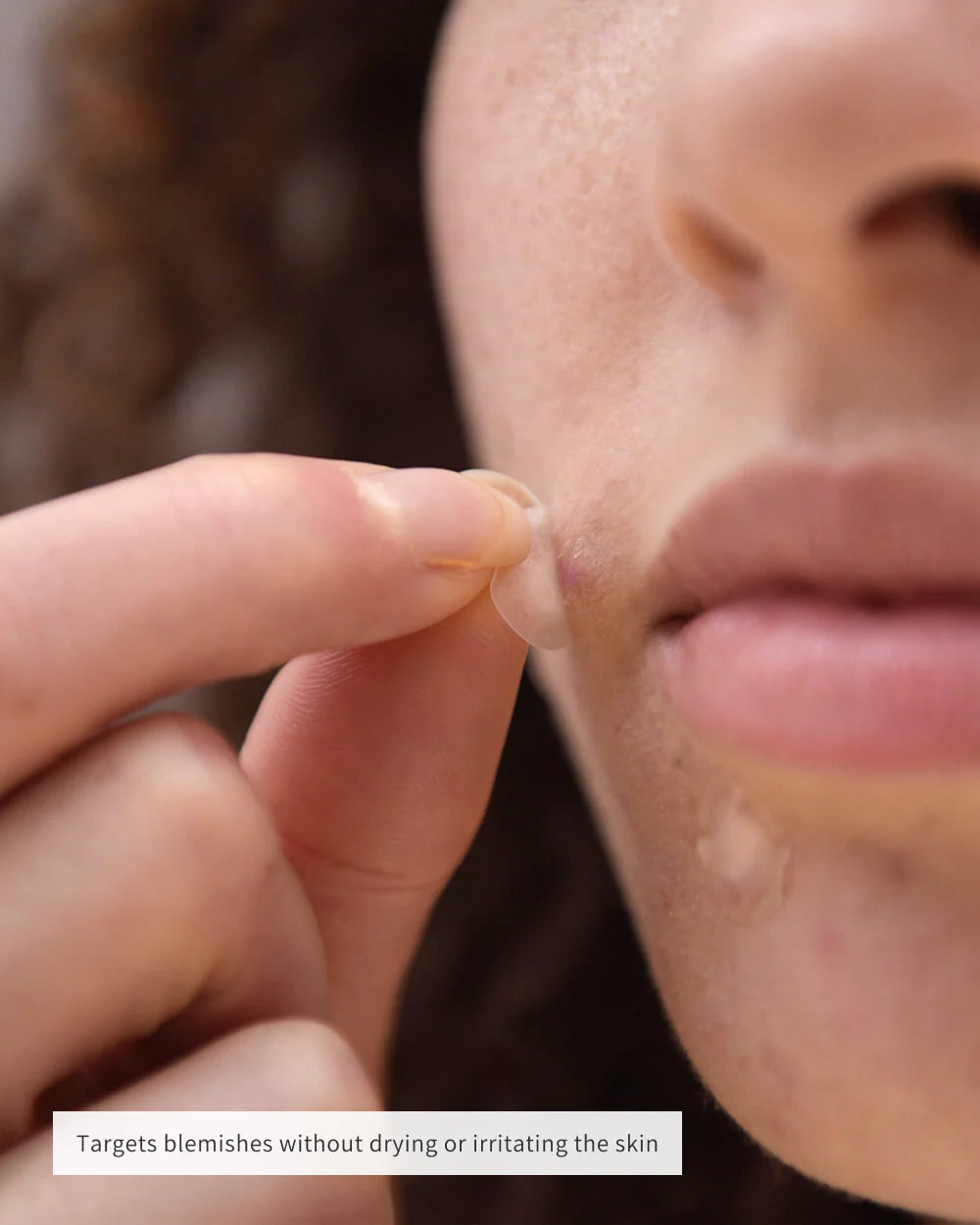 CLEARING SPOT PATCHES